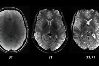 World's Most Powerful MRI Iseult Captures First Unprecedented Images of the Human Brain